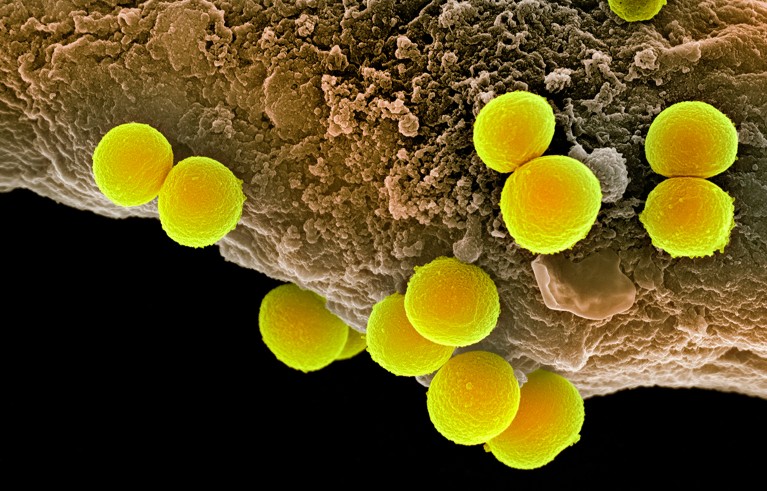 Staphylococcus aureus bacteria. Coloured scanning electron micrograph (SEM) of Staphylococcus aureus bacteria (round) on a human phagocyte white blood cell.