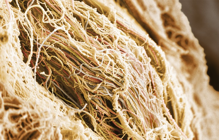 Coloured scanning electron micrograph of human cartilage tissue