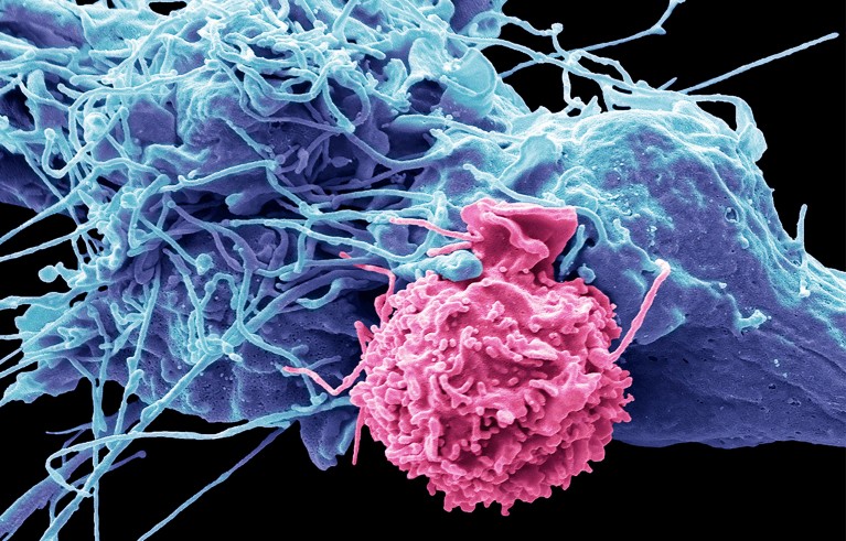 Natural killer (NK) cell interacting with hepatoma cell (HepG2). Coloured scanning electron micrograph (SEM).