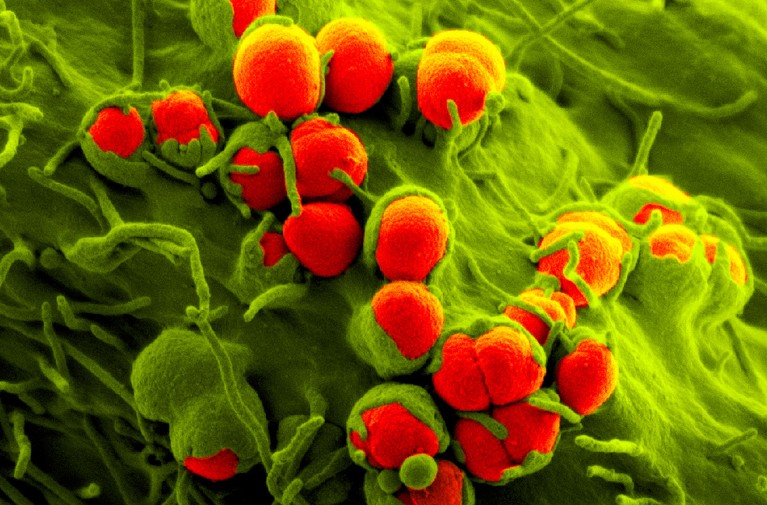 Coloured scanning electron micrograph of gonorrhoea bacteria (Neisseria gonorrhoeae, round) on a human epithelial cell.