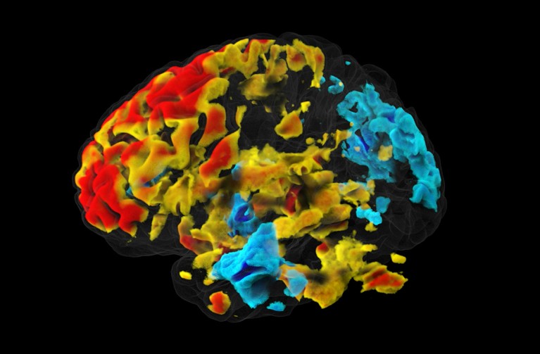 Coloured functional magnetic resonance imaging (fMRI) scan of a healthy human brain at rest.