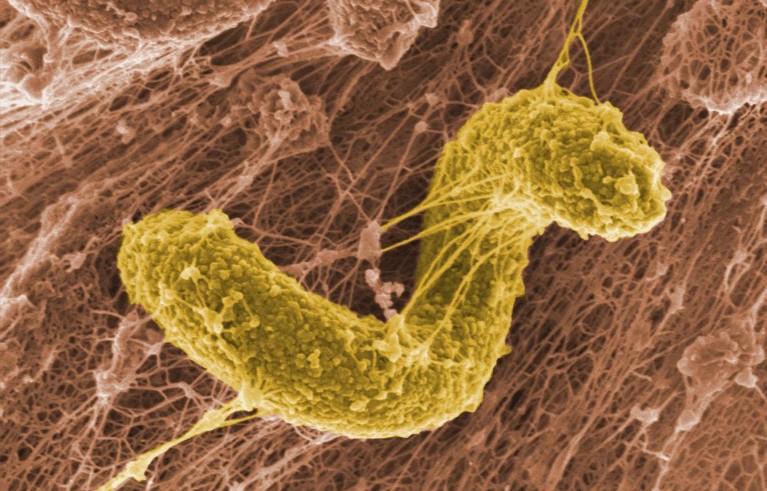 A colourised micrograph image of a Desulfovibrio desulfurican.