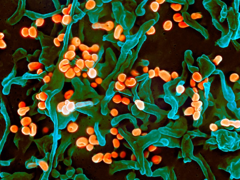 Coloured scanning electron micrograph showing lassa virus particles in orange