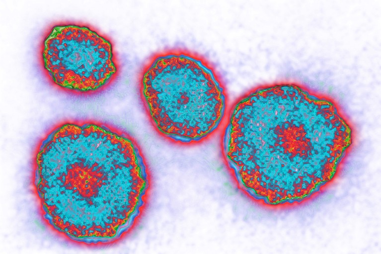 Enhanced transmission electron micrograph of the mumps virus shown in blue, green and pink colours