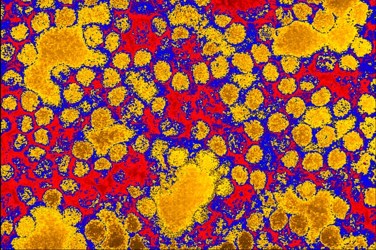 Coloured transmission electron micrograph of yellow fever viruses, shown in bright yellow, red and blue colours