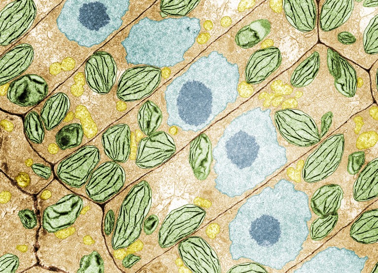 Coloured transmission electron micrograph (TEM) of duckweed (Spirodela oligorrhiza) root cells, showing cell walls, centralized nuclei and numerous chloroplasts