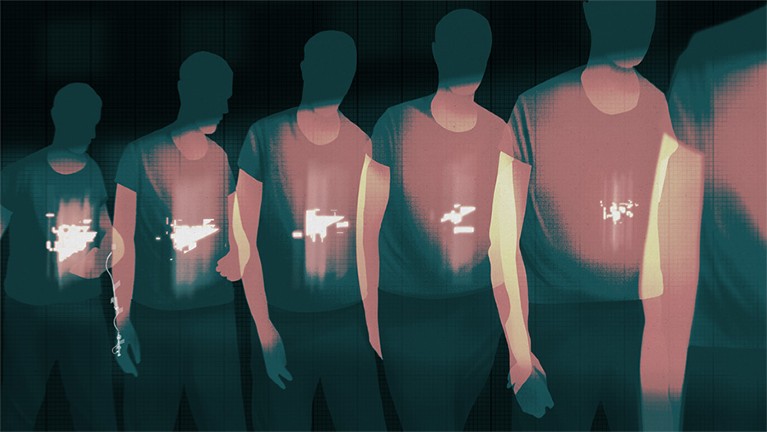 A conceptual illustration showing pancreatic cancer is noticeably shrinking, as a man's body is scanned repeatedly before and after treatment.