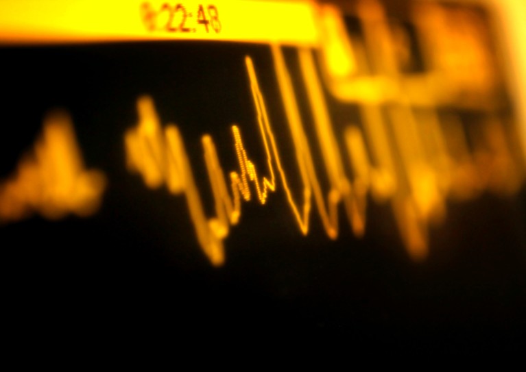 A close-up of an orange ECG heart trace showing an irregular heartbeat on a black background
