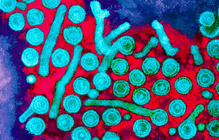 Coloured transmission electron micrograph of Hepatitis B viruses, showing numerous round turquoise particles and elongated red and cyan forms against a dark blue background.