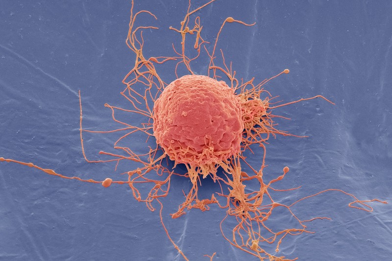 A human mesenchymal stem cell