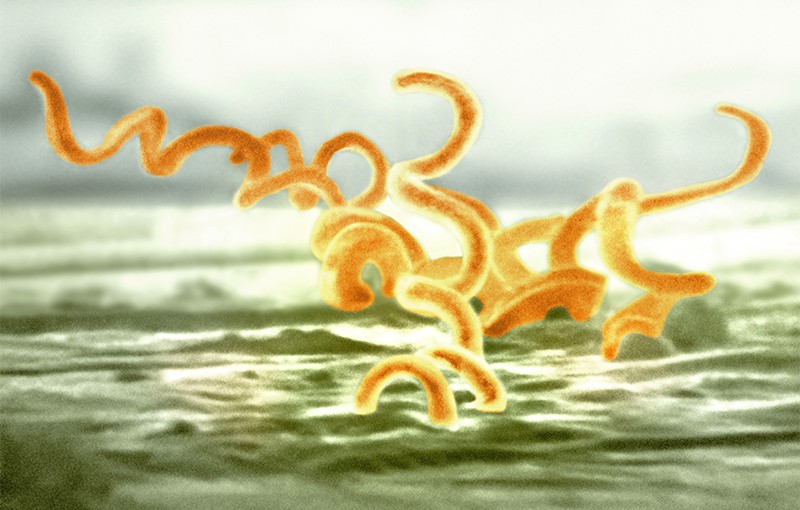 SEM of spirochaete bacteria Treponema pallidum, visible as orange spirals.