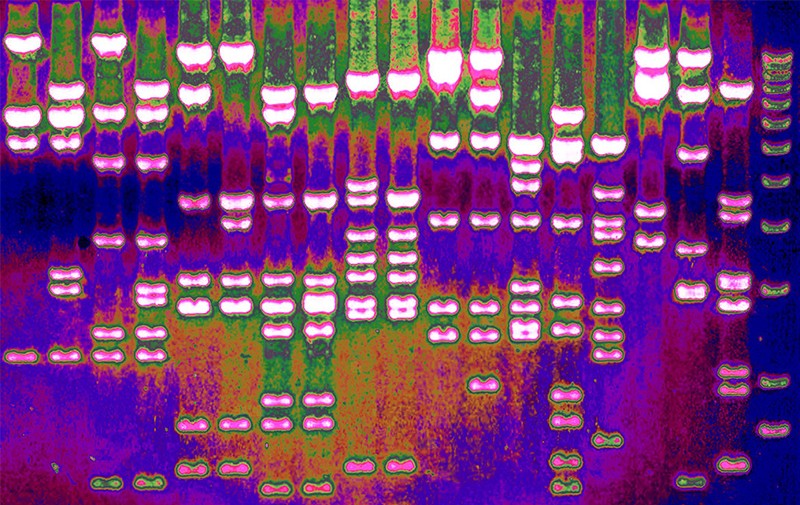 Colourful image of the separation of DNA fragments by electrophoresis through an agarose gel.