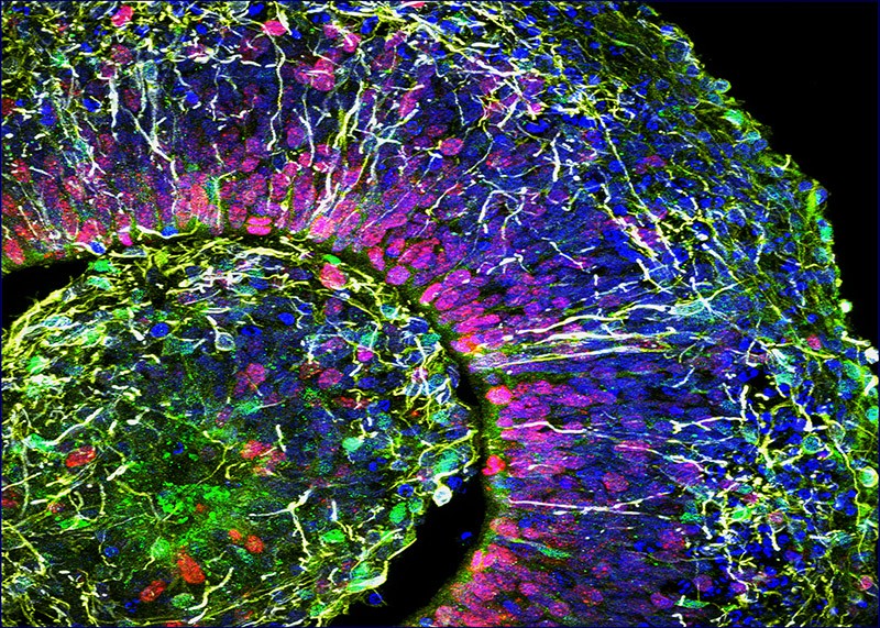 Un corte en el ‘ mini cerebro' permite ver neuronas corticales maduras en el extremo. Fotografía de Muotri. 