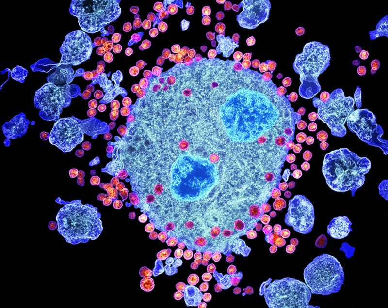 Coloured transmission electron micrograph of budding HIV particles