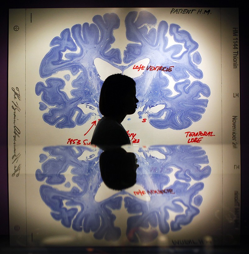 A woman walks past a display of a brain slice.