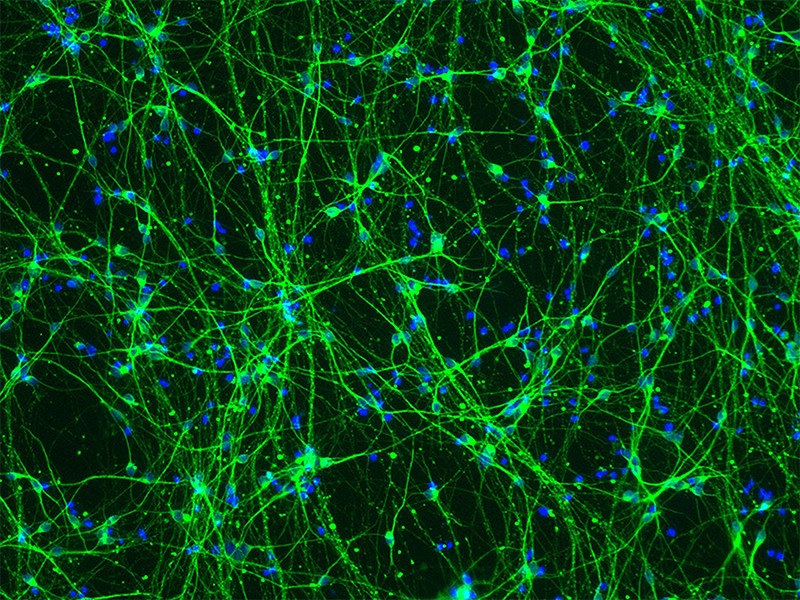 Light micrograph showing neurons derived from stem cells