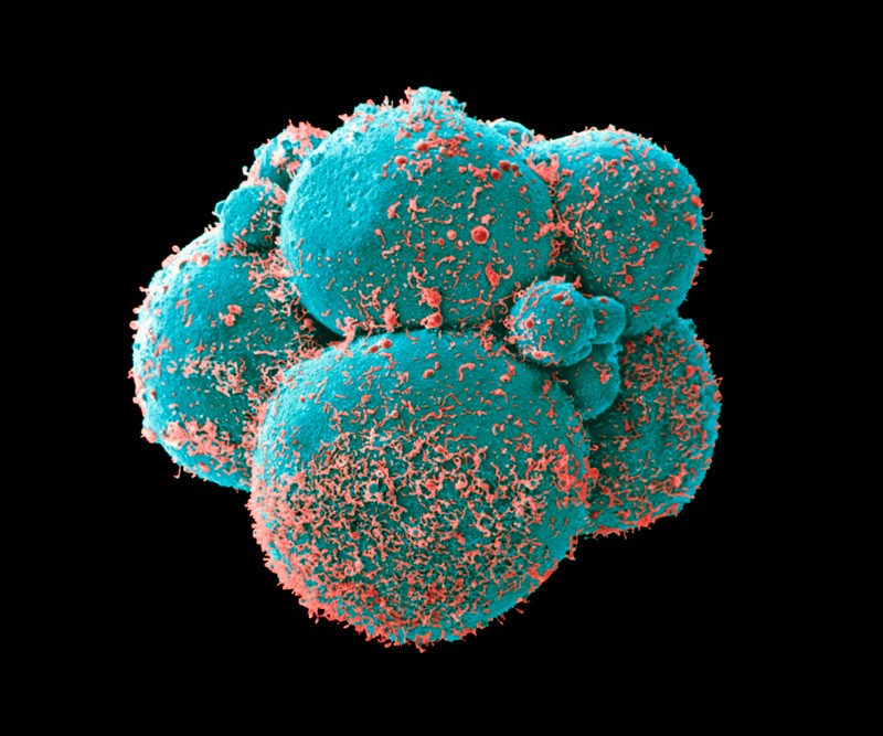 Coloured scanning electron micrograph (SEM) of a human embryo at the eight cell stage