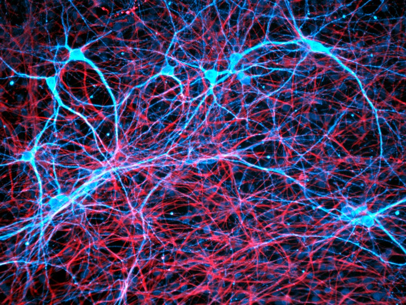 Nerve and glial cells, fluorescence light micrograph.