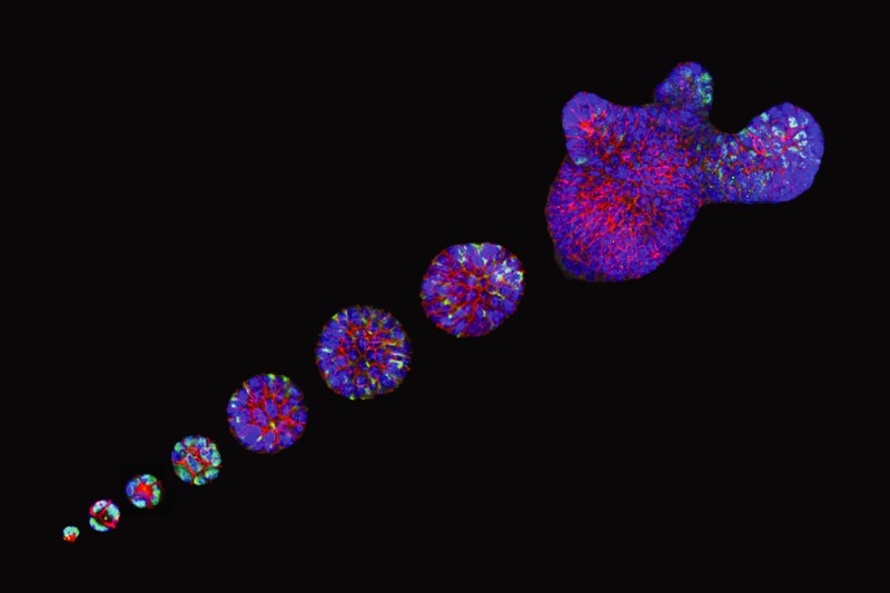 Composite image of intestinal organoids at different developmental stages