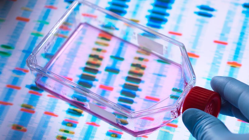 A hand in a plastic glove holding a clear plastic bottle over a screen displaying DNA profiles.